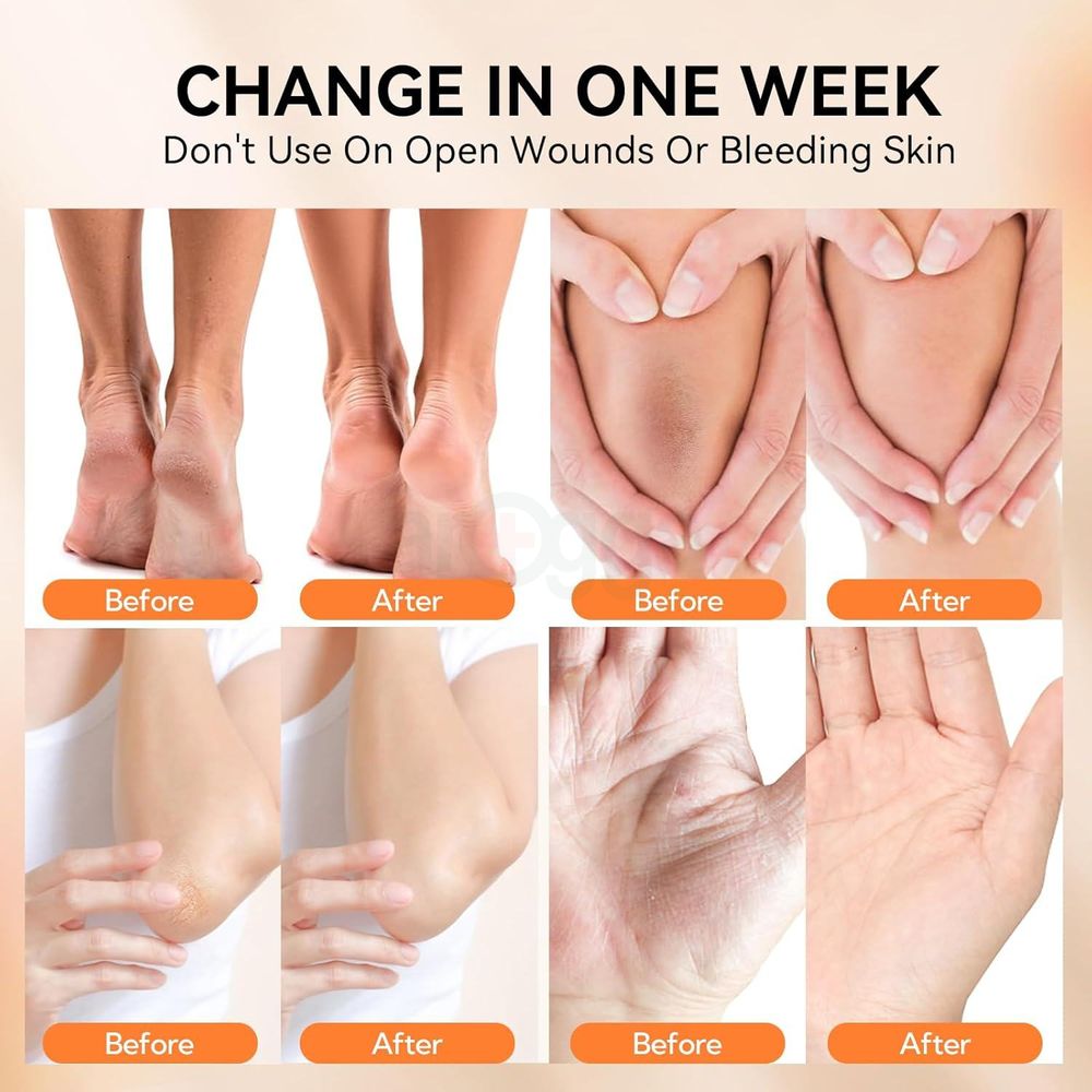 Lanbena Foot Repair Cream 100g  