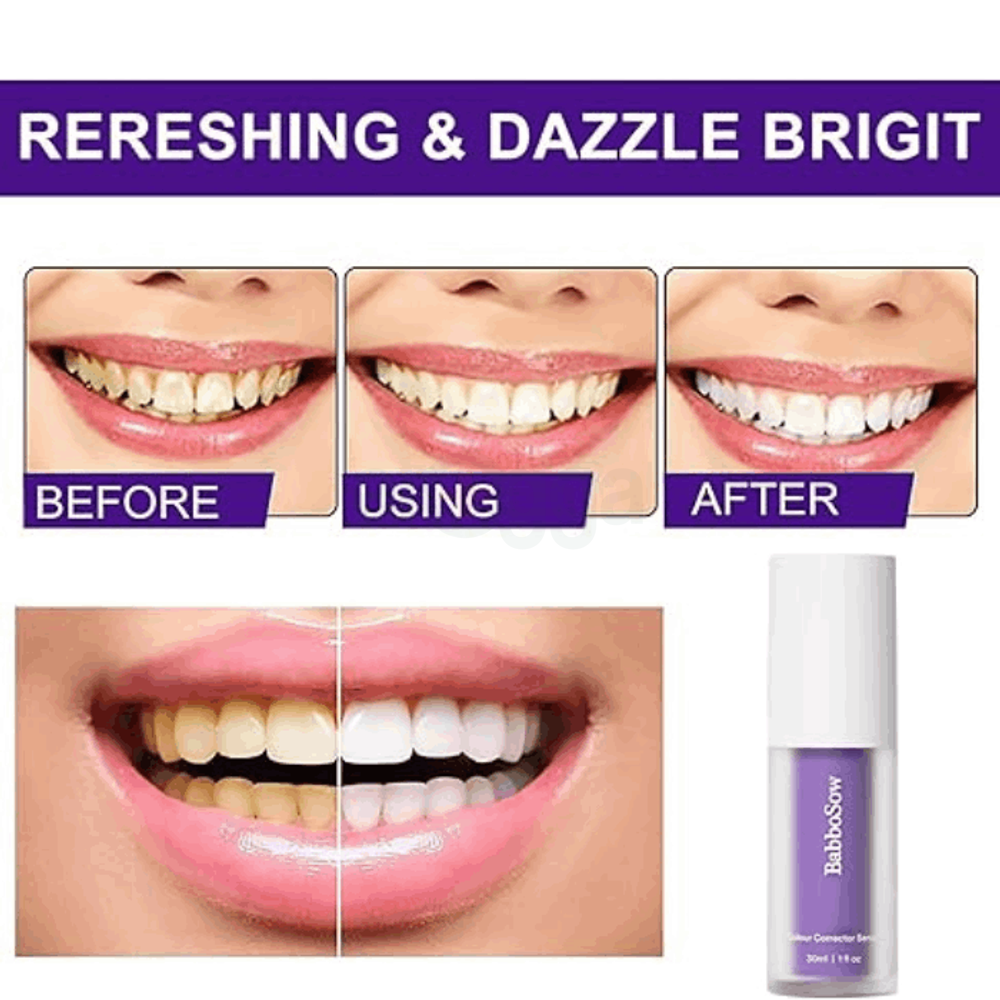 Babbosow Teeth Brightening Serum  