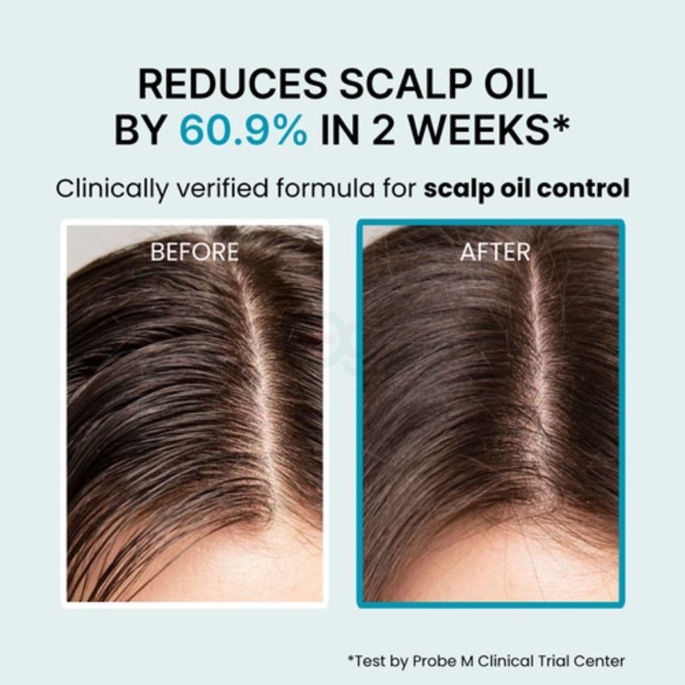 Nesh Mint Biome Scalp Deep Cleansing Shampoo for Oil - Prone Scalp 250ml  