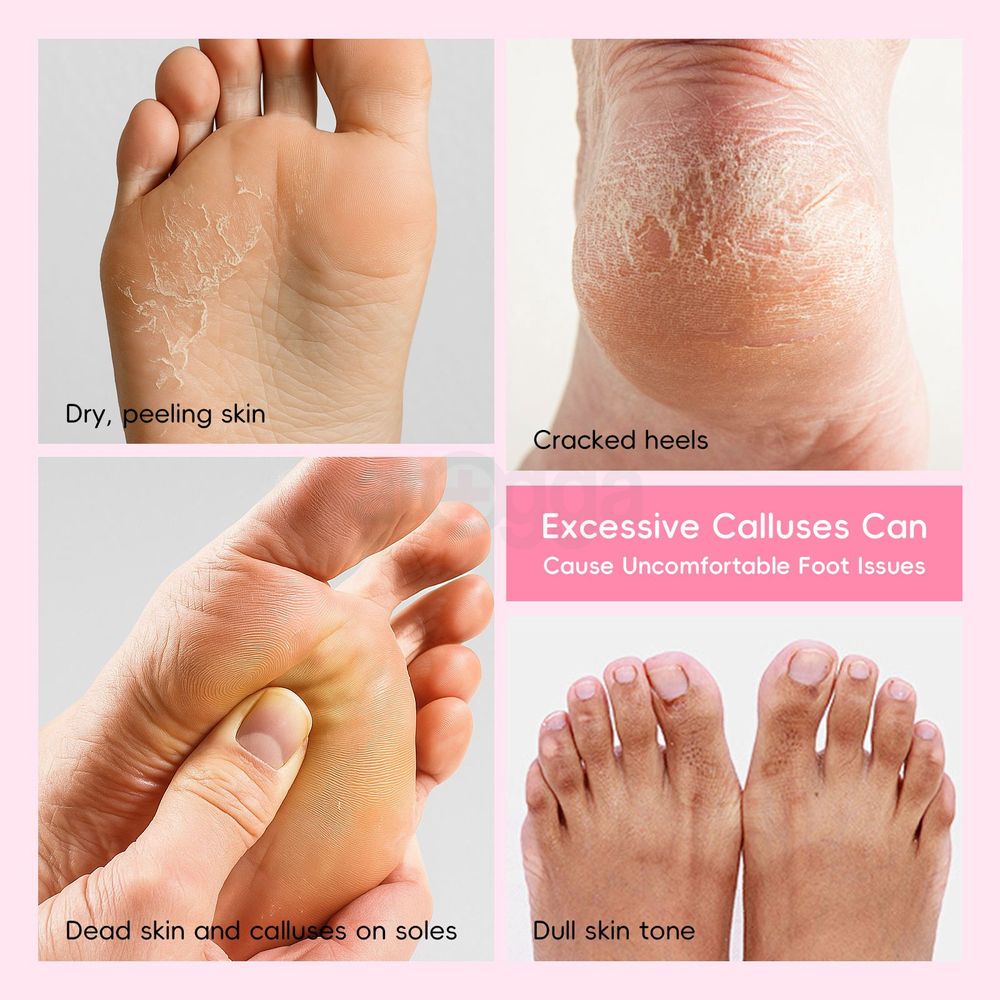 Laikou Japan Sakura Foot Peel Mask 40g  