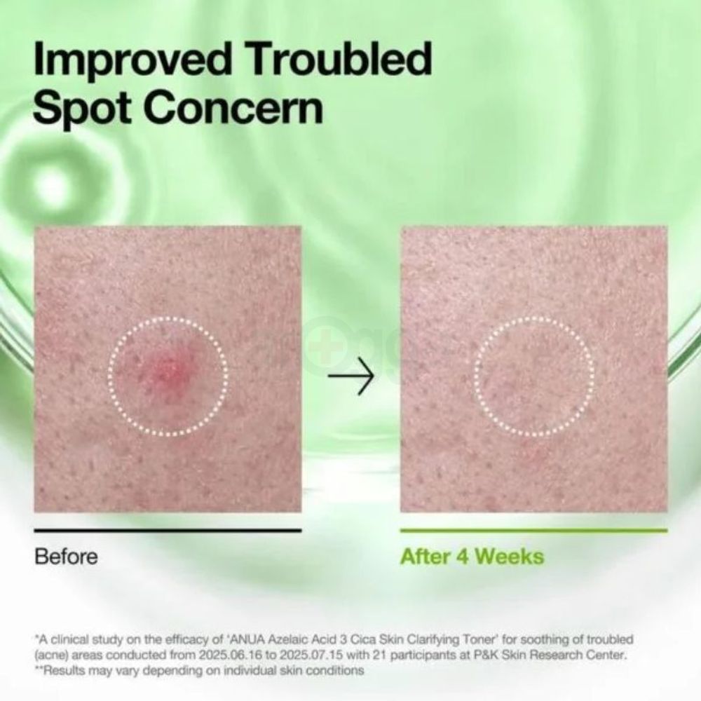 Anua Azelaic Acid 3+ Cica Skin Clarifying Toner 250ml  