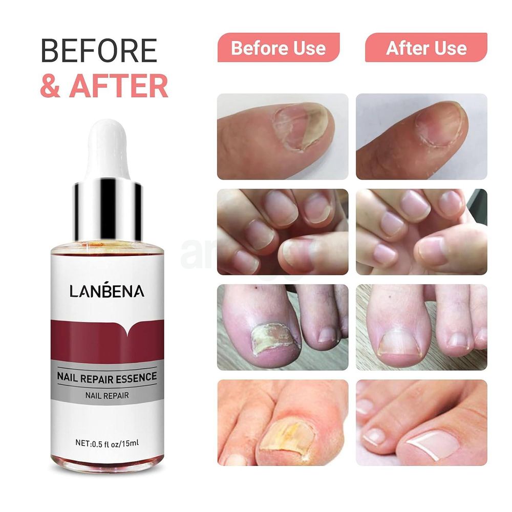 LANBENA Nail Repair Essence  