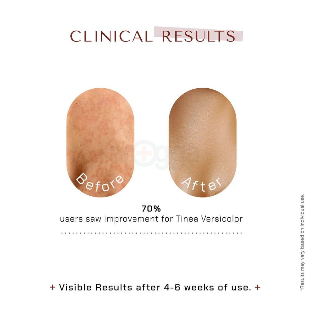 The Remedist by Dr Rhazes Kenzo F Soap 100g  