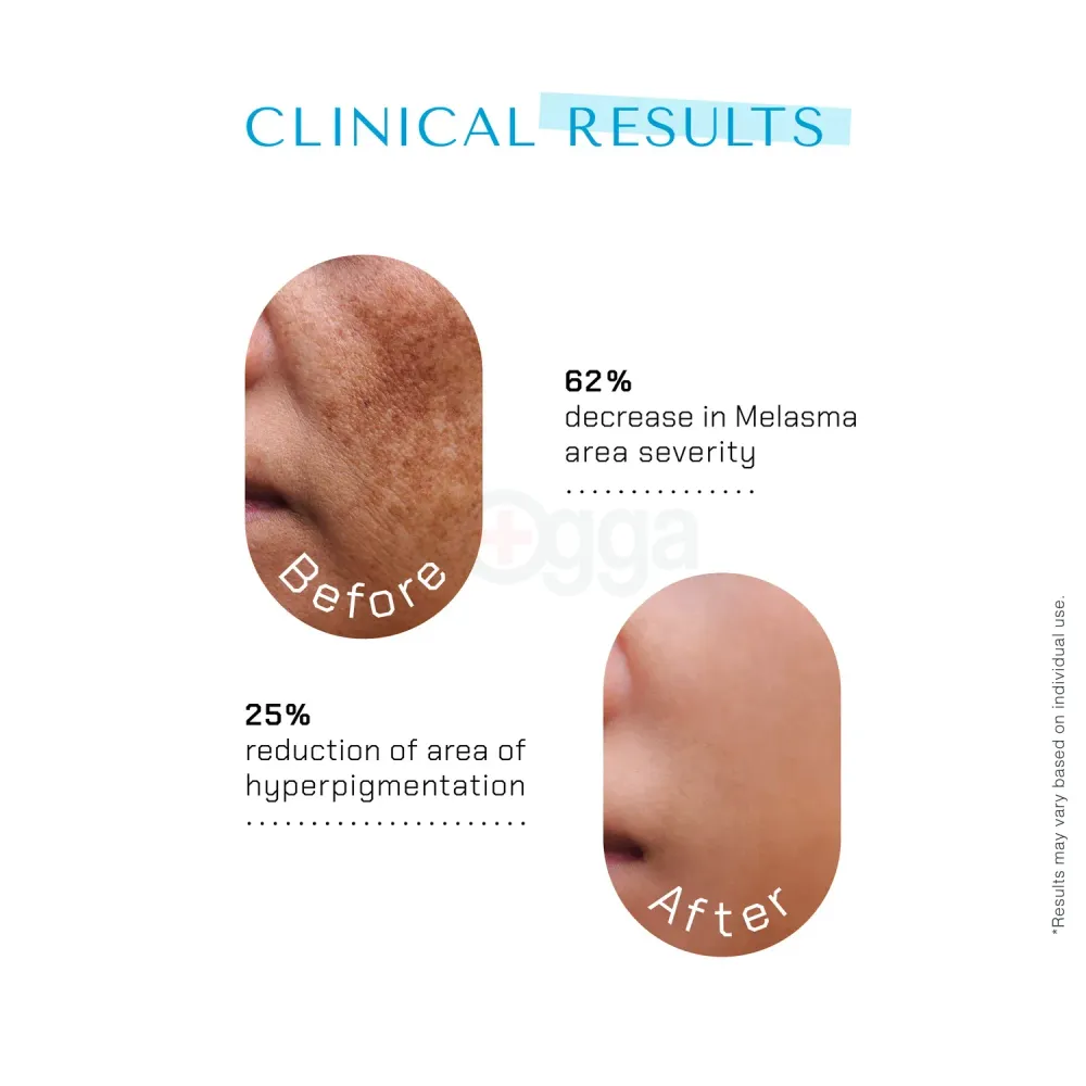 The Remedist by Dr Rhazes Niacinamide PC & Zinc Face Serum 30ml  