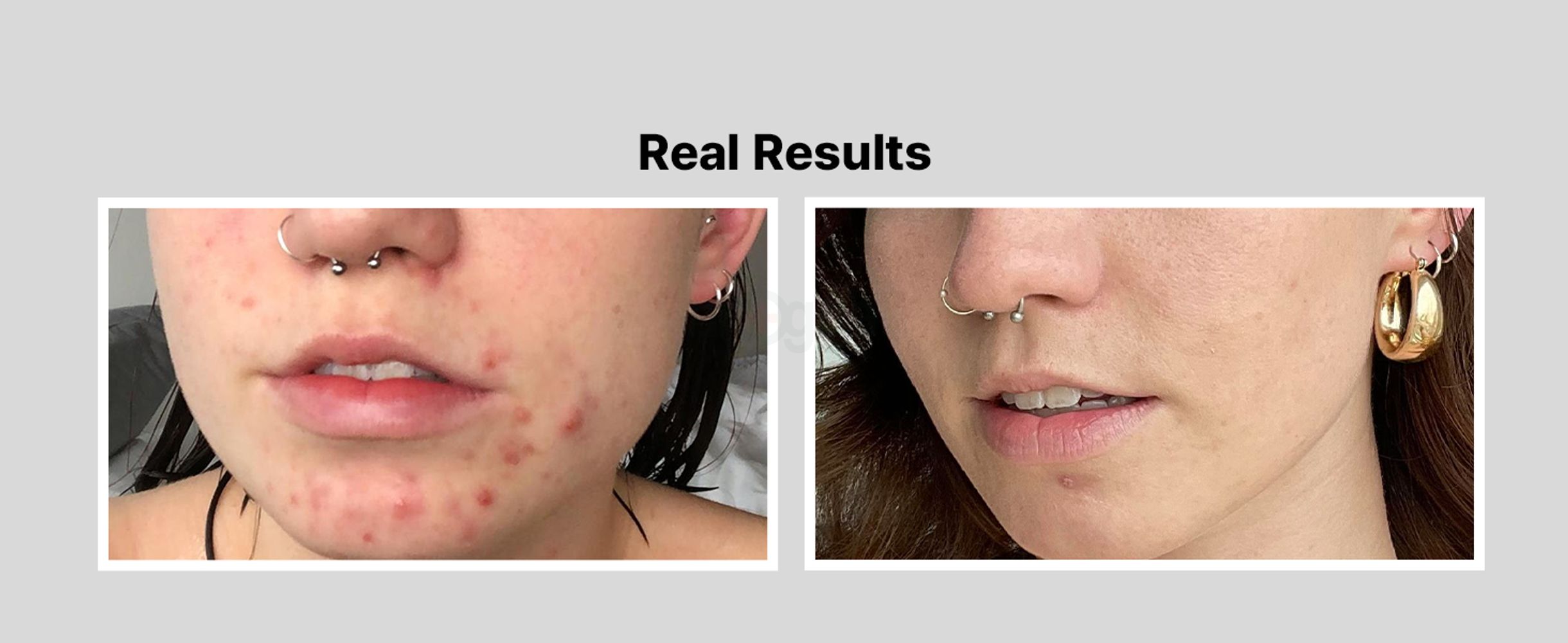 real results based on cliniccal trials tested safe to use on sensitive skin