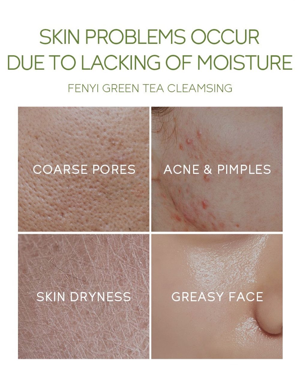 eyJidWNrZXQiOiJhcm9nZ2EiLCJrZXkiOiJtZWRpY2luZURlc2NyaXB0aW9uXC81NVwvNTU4MTctNG1qZ2V6MWZlem91OS5qcGVnIiwiZWRpdHMiOltdfQ==