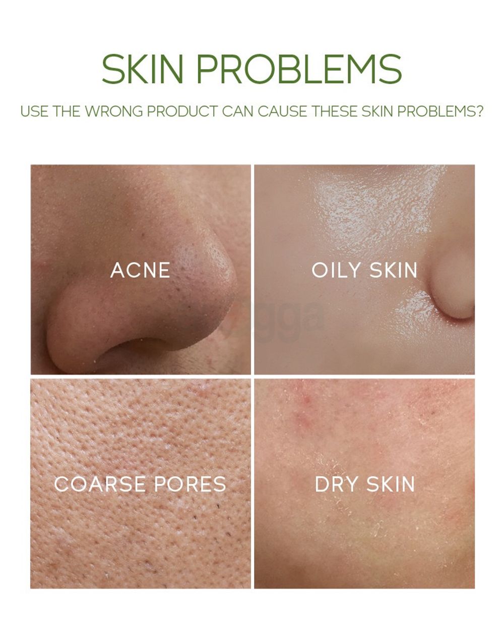 eyJidWNrZXQiOiJhcm9nZ2EiLCJrZXkiOiJtZWRpY2luZURlc2NyaXB0aW9uXC81NVwvNTU4MjEtNDB6cGhmZnV1bWYzOC5qcGVnIiwiZWRpdHMiOltdfQ==