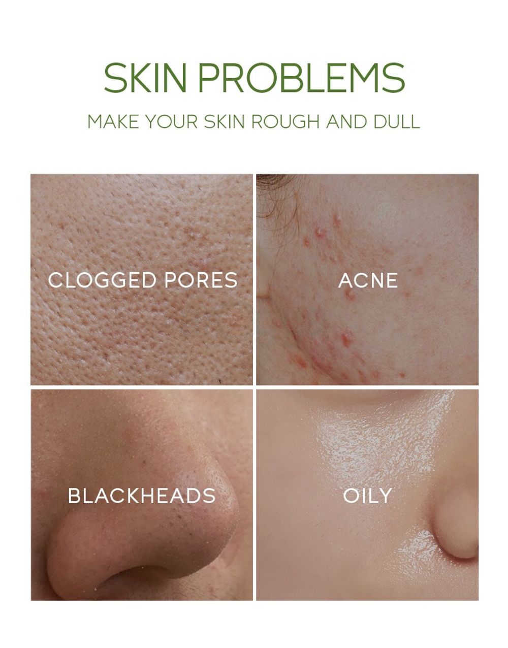 eyJidWNrZXQiOiJhcm9nZ2EiLCJrZXkiOiJtZWRpY2luZURlc2NyaXB0aW9uXC81NVwvNTU4MjgtNDN0cGV5ODJ4YWV1Zy5qcGVnIiwiZWRpdHMiOltdfQ==