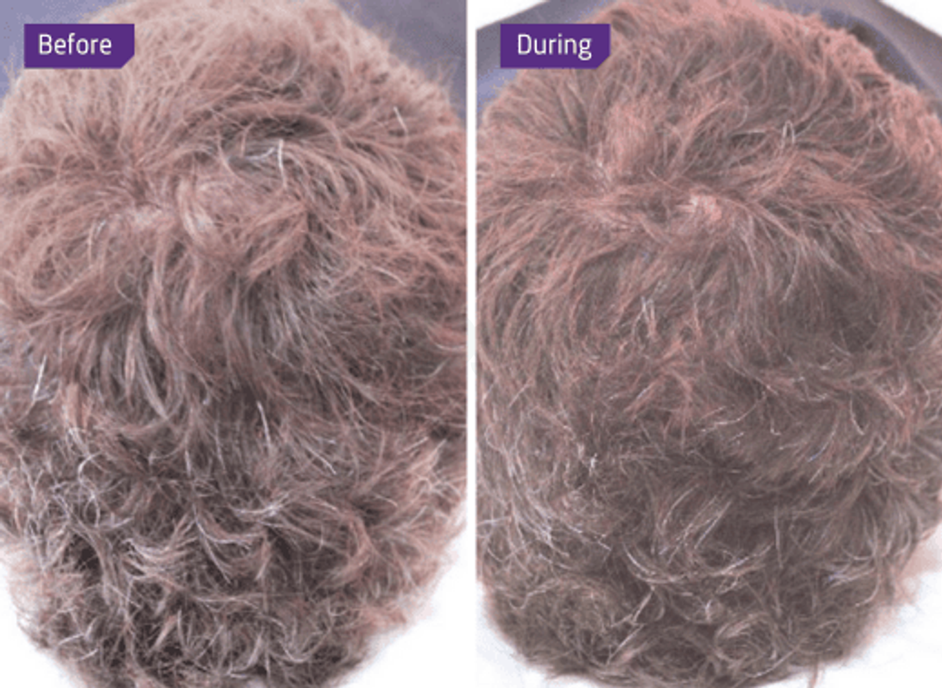 Before and after Anti Grey.png__PID:7857baae-48a2-4d7a-b86c-1707ed29670a