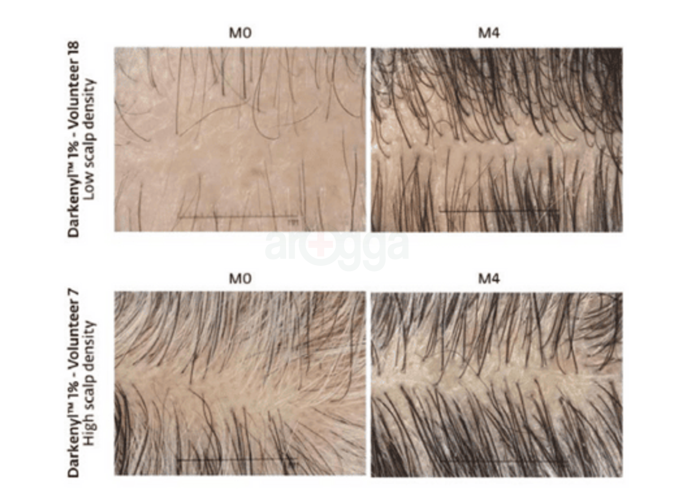 Before and after Anti Grey (3).png__PID:31bb950f-d9a3-4f92-8d6a-fe6163250925