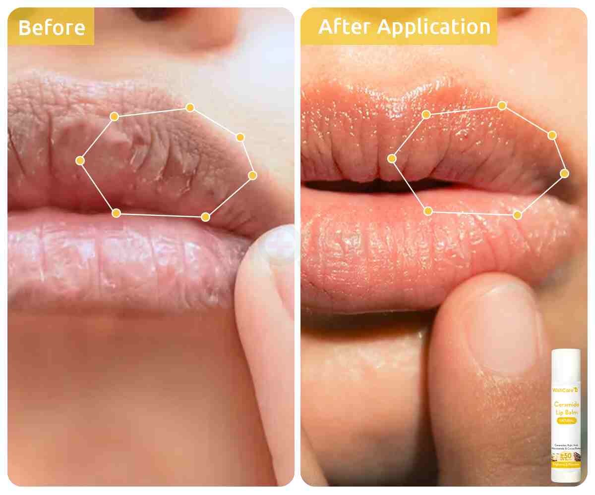 eyJidWNrZXQiOiJhcm9nZ2EiLCJrZXkiOiJtZWRpY2luZURlc2NyaXB0aW9uXC83MlwvNzIyMjQtMTE0MXVpbWxueGQybmEuanBlZyIsImVkaXRzIjpbXX0=