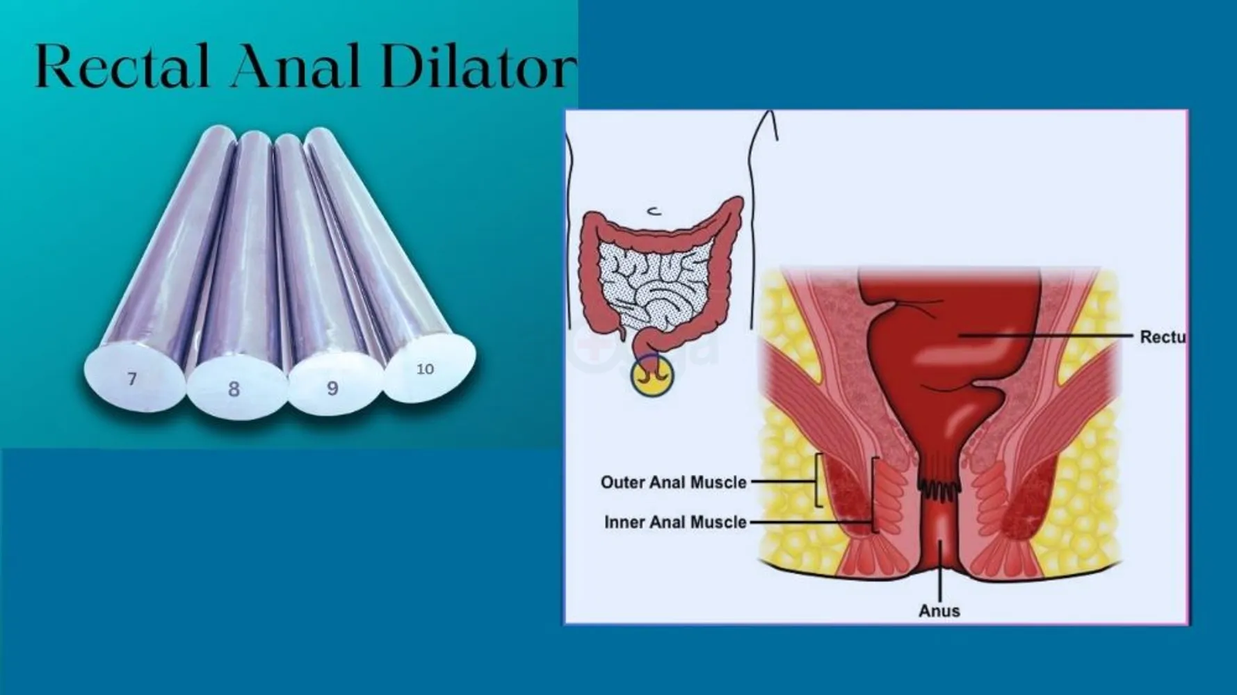 Porno garajda ushlangan
